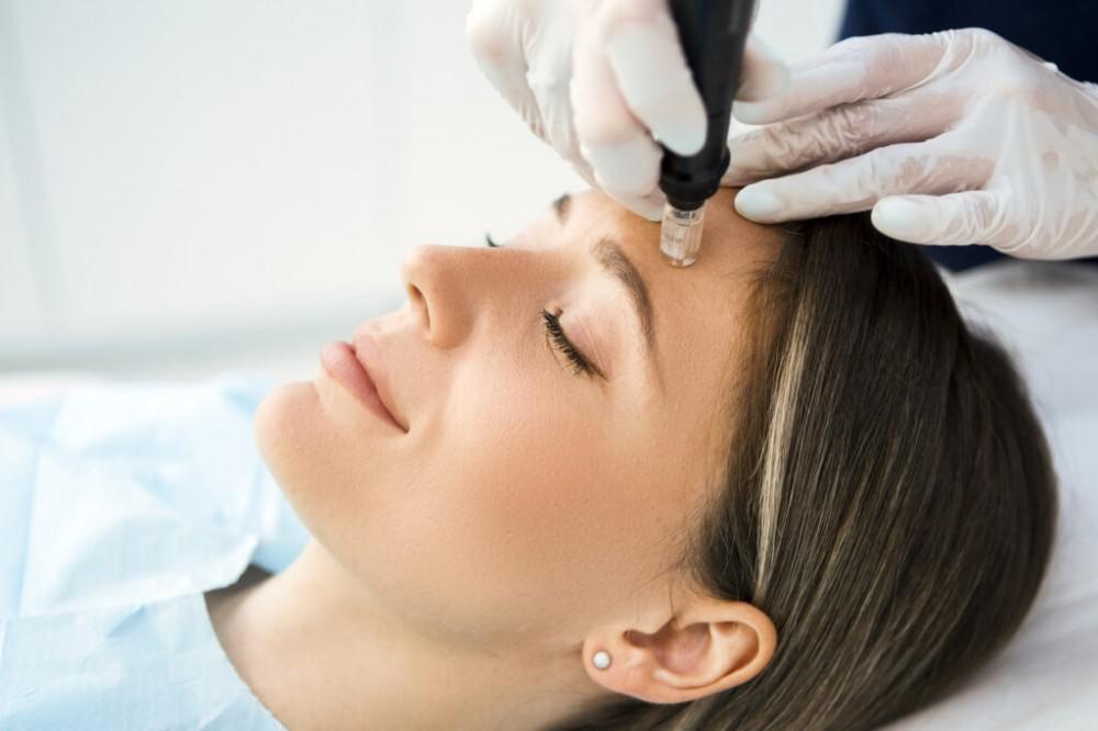 An Overview of Radiofrequency Microneedling